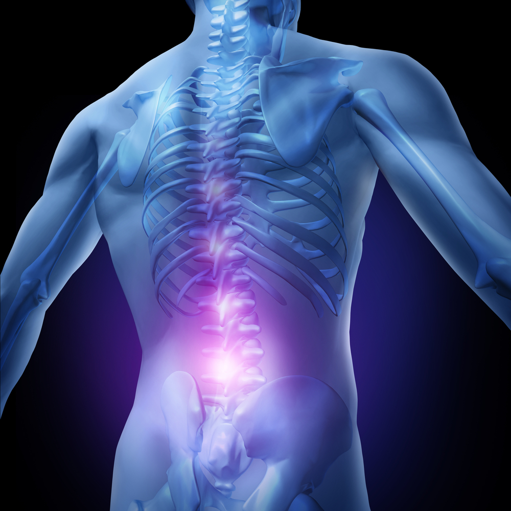 Spinal Cord Injury lawyer Lakeland, FL